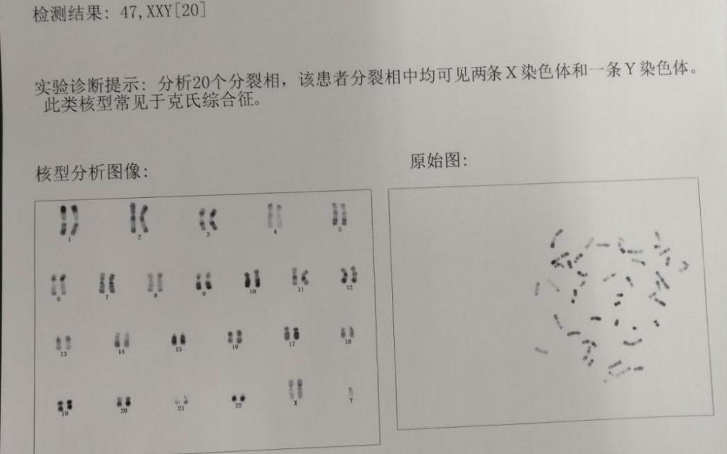 男性染色体异常是可以做试管婴儿的吗?(图1)