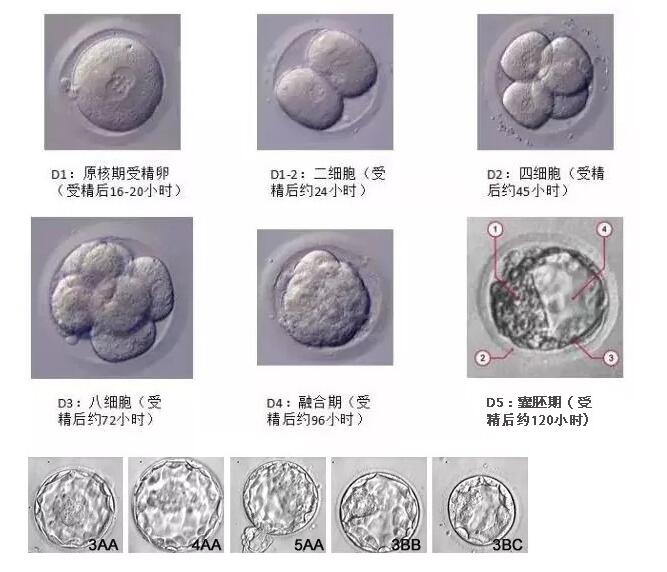 为什么囊胚的试管婴儿成功率更高？(图1)