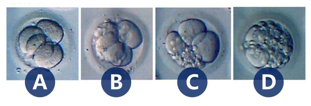 囊胚移植可增加试管婴儿受孕率(图1)
