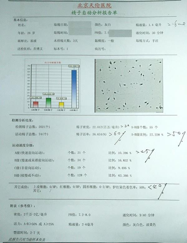 常规精液检查(图1)