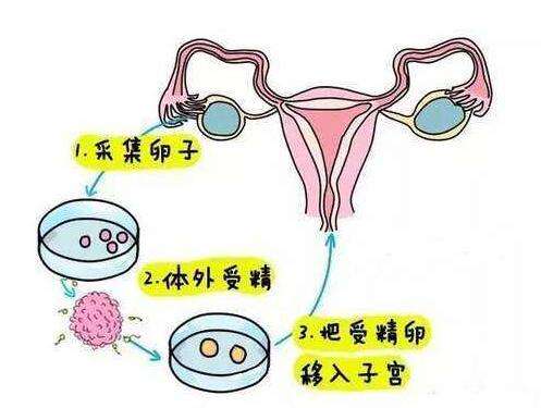 促排卵不是所谓的透支未来的卵子(图1)