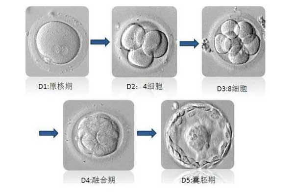 不孕不育做乌克兰试管的流程安排是什么?(图4)