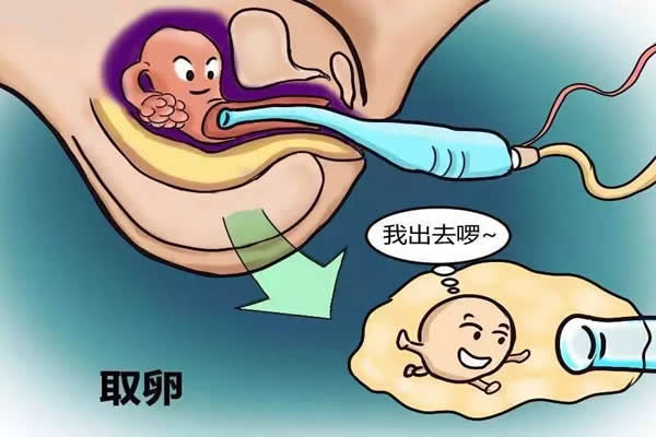 试管婴儿取卵时疼吗