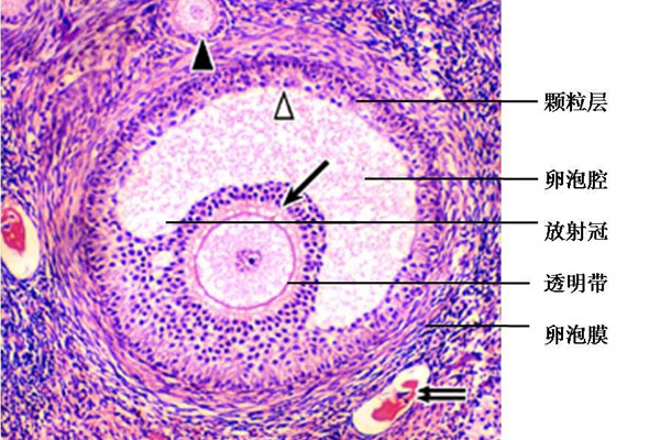 怎么防止卵泡是空泡