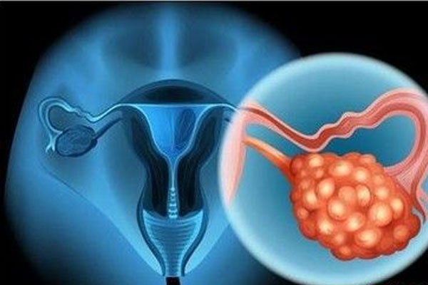 卵巢功能是影响试管婴儿成功率的因素