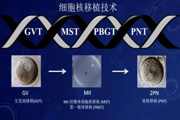 第四代试管是什么技术