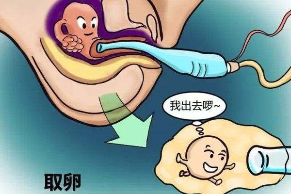 试管婴儿取卵流程