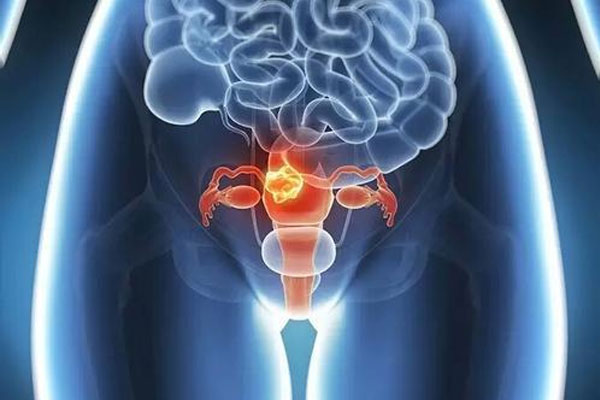 导致卵巢功能早衰的病因有那些及卵巢早衰的症状