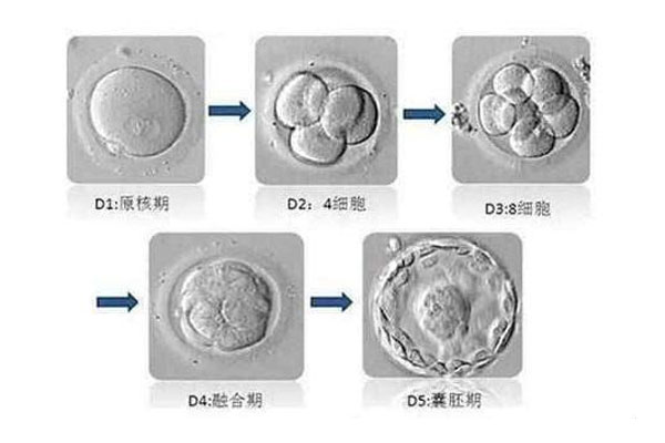 鲜胚移植