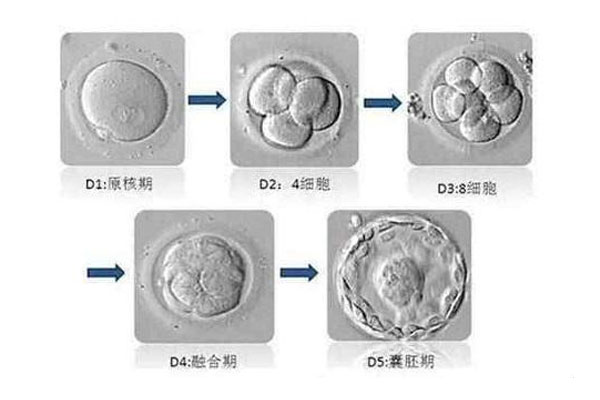 鲜胚移植