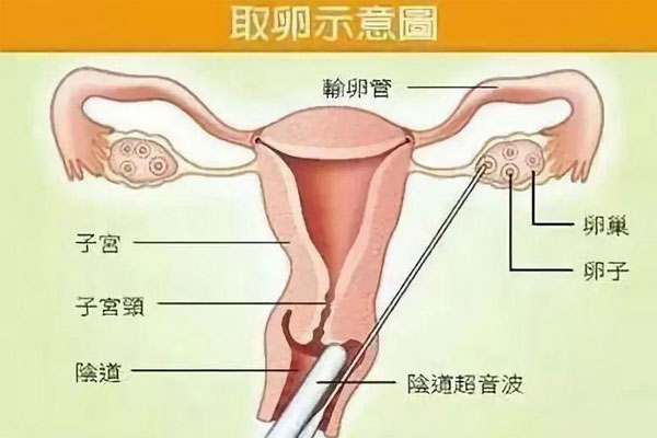 盐城供卵试管全部费用流程-有史以来最全面