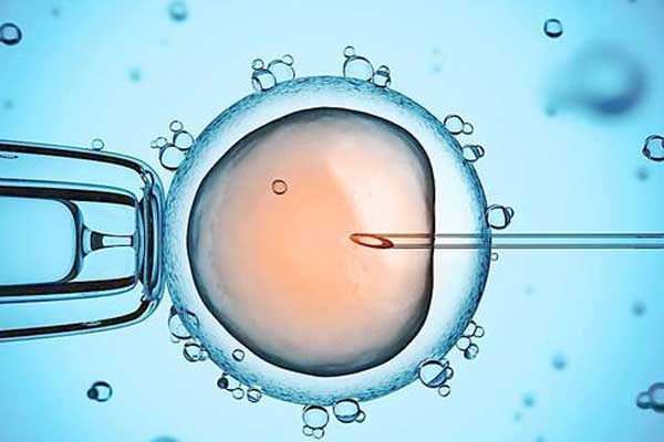 试管婴儿优生3法宝：PGD、PGS、NIPT，备孕爸妈要分(图1)