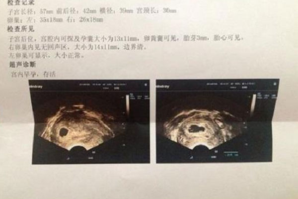 长出的多为胎芽，并不会长出胎心
