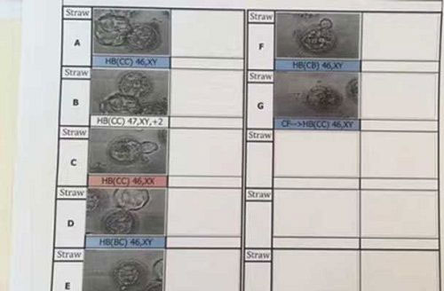 赴泰art医院三代试管亲身经历详细记录(图5) art试管婴儿胚囊发育报告单